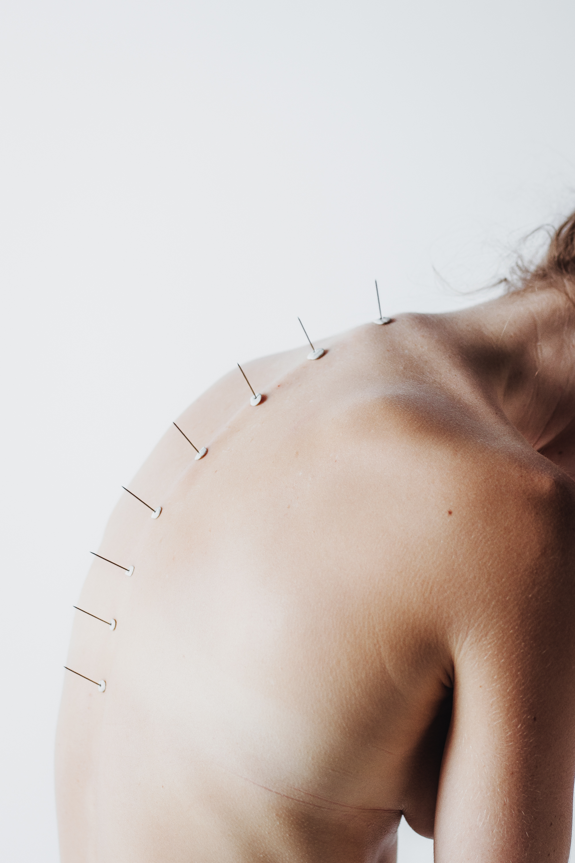 Anæsthesia by Anæsthesia — image 2 of 4