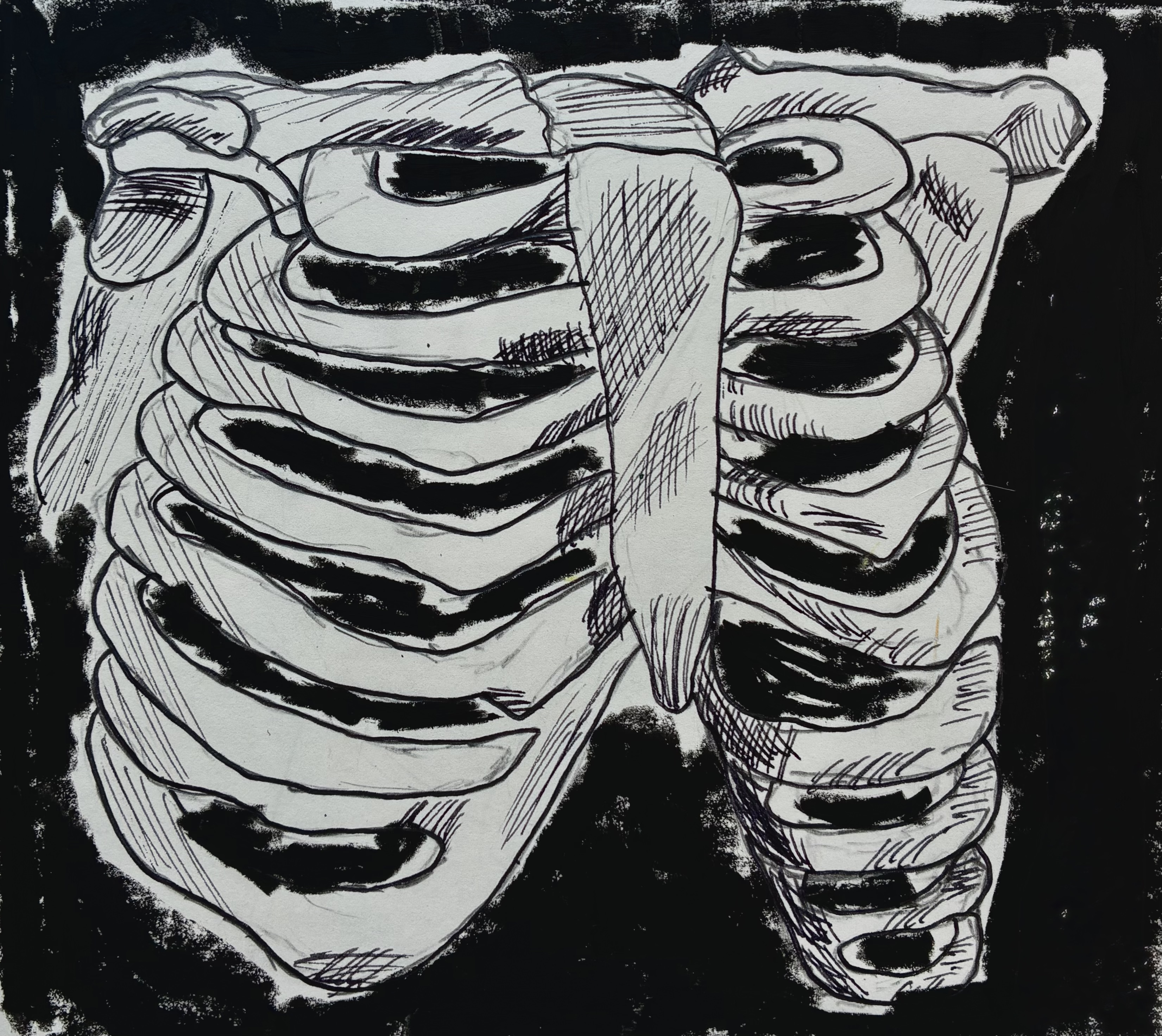 Ribcage